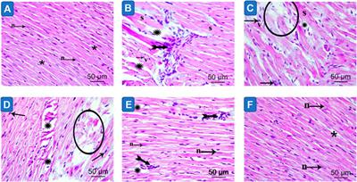 A Nano-Pharmaceutical Formula of Quercetin Protects from Cardiovascular Complications Associated with Metabolic Syndrome